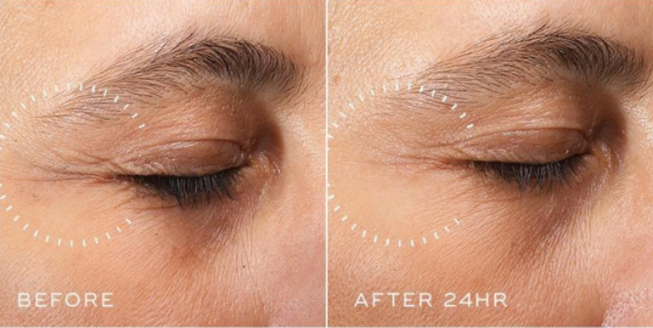 Crystal Retinal Ceramide Eye 3